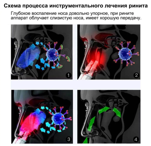 Прибор от насморка "Здоровый носик", инфракрасный препарат для лечения ринита фото 5